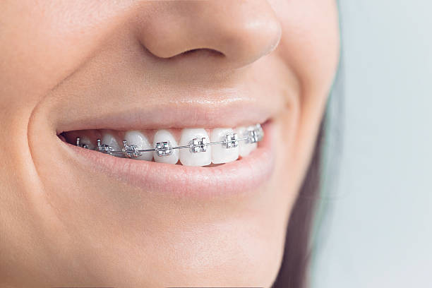 Best Laser Dentistry  in Aurora, SD